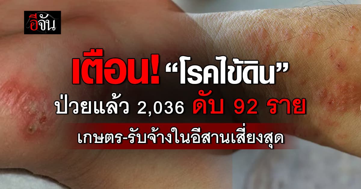 รัฐฯ เตือน “โรคไข้ดิน” ป่วยแล้ว 2,036 ราย ดับ 92 ราย  