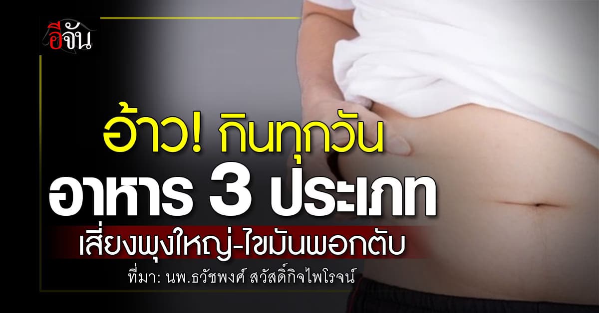 หมอ เตือน! อาหาร 3 ประเภท เพิ่มความเสี่ยง พุงใหญ่-ไขมันพอกตับ  