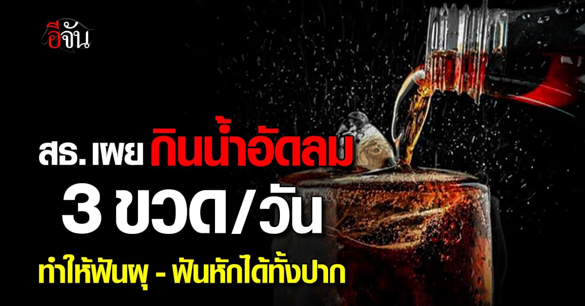 กินน้อยลง! สธ. เผย กินน้ำอัดลม 3 ขวด/วัน ทำให้ฟันพัง
