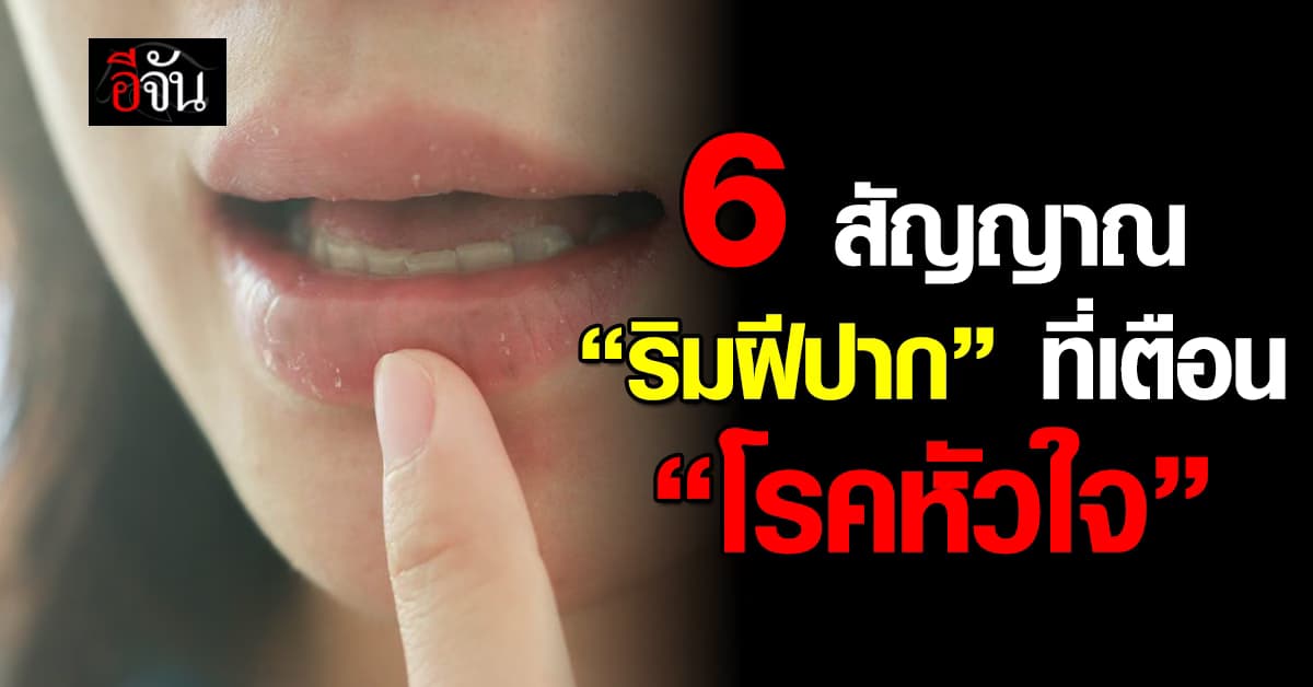 6 สัญญาณจาก “ริมฝีปาก” ที่อาจบอกว่ากำลังเสี่ยงเป็น “โรคหัวใจ” 