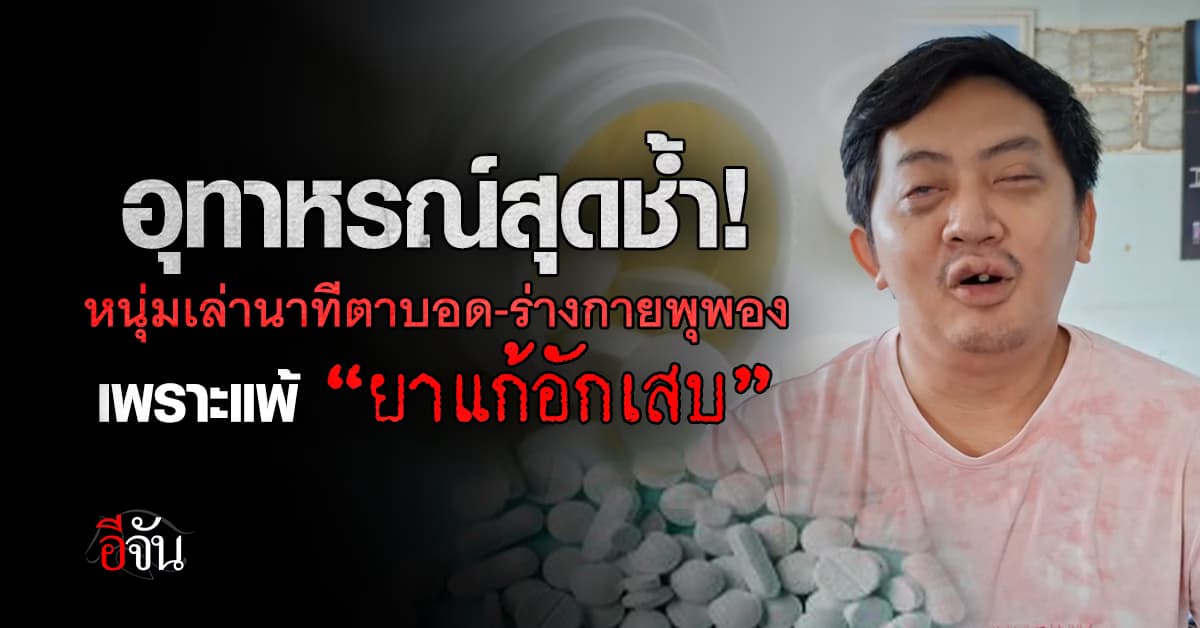 หนุ่มเปิดใจ! หลังกินยาแก้อักเสบ ตื่นมาร่างกายพุพอง-ตาบอดถาวร 