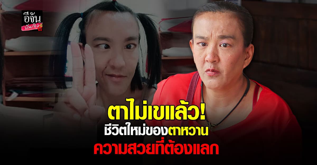 เปิดภาพปัจจุบัน ตาหวาน ดอกกระโดน กับดวงตาคู่ใหม่