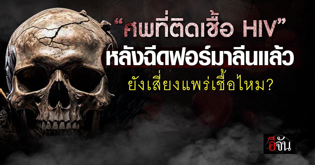 ไขข้อสงสัย! ศพที่ติดเชื้อ HIV ยังเสี่ยงแพร่เชื้อไหม? 