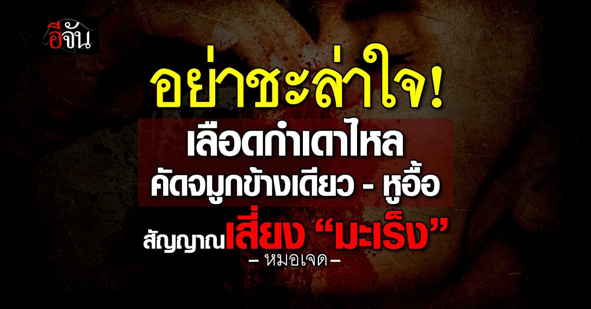 หมอเจดเตือน 3 อาการ “เลือดกำเดาไหล คัดจมูก หูอื้อ” สัญญาณเสี่ยง “มะเร็ง” 