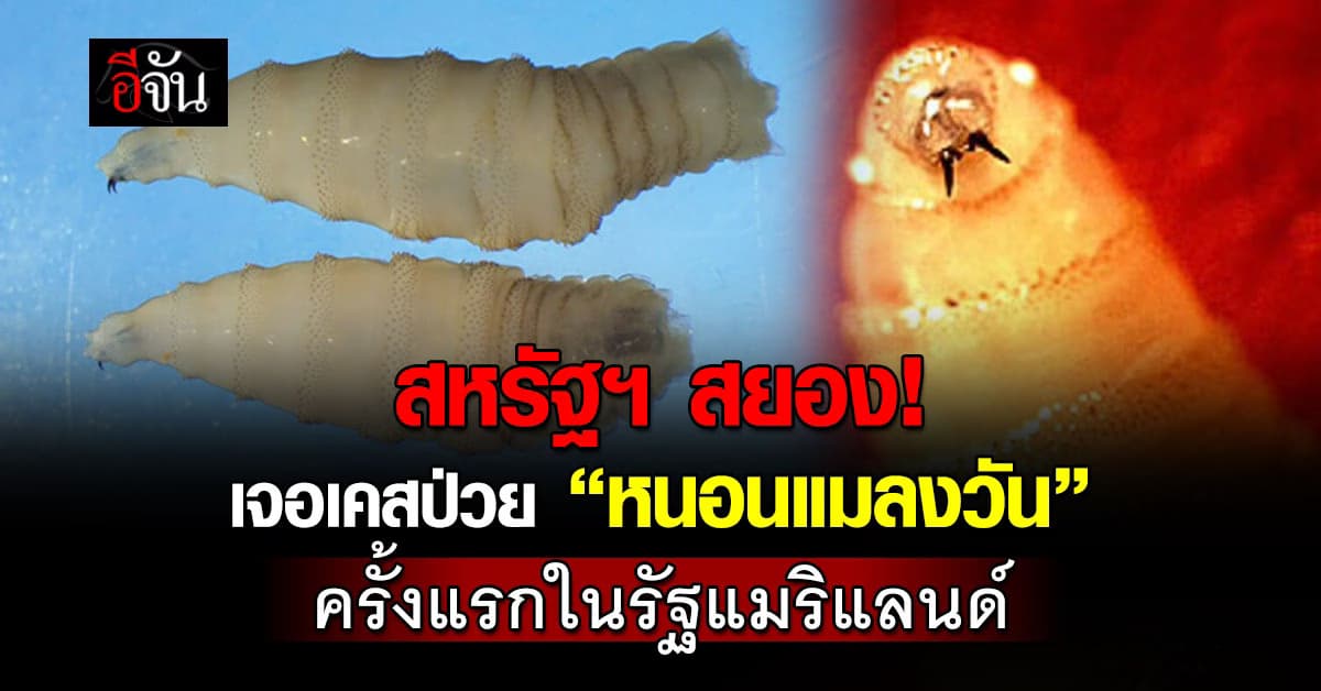 สหรัฐฯ เจอเคสผู้ป่วย “โรคหนอนแมลงวัน” ครั้งแรกของปี 