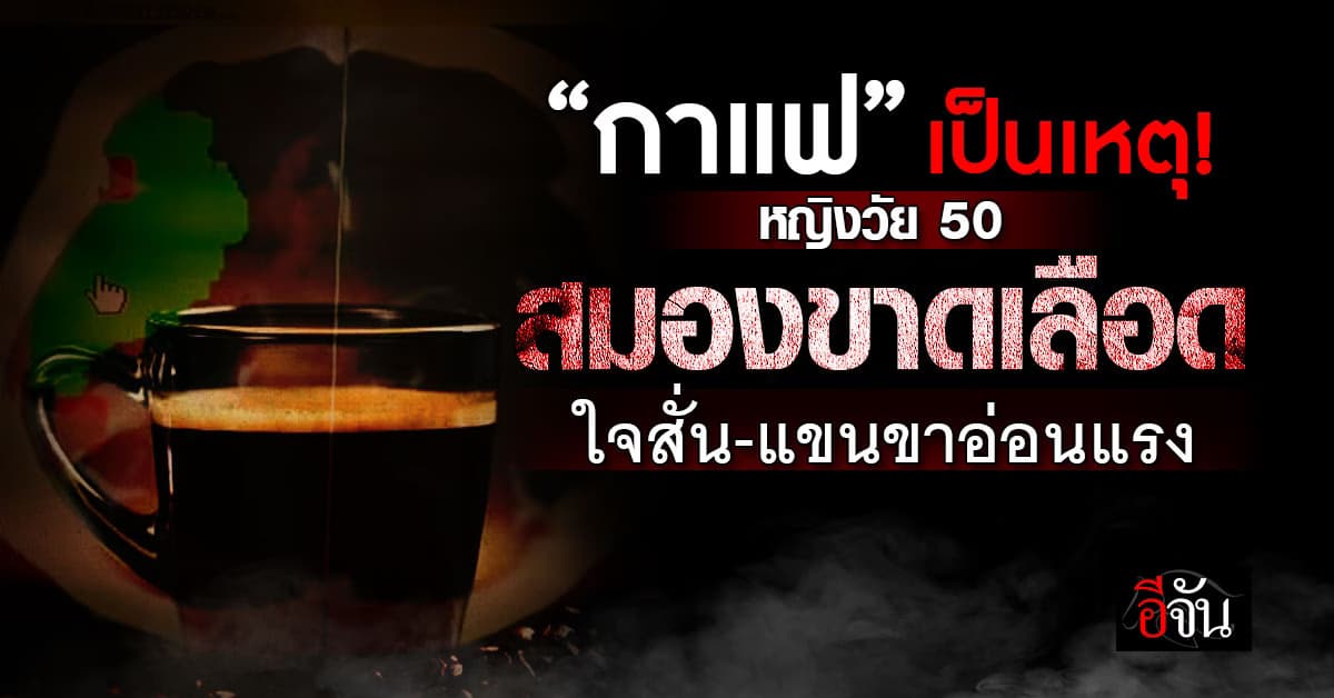 หญิงวัย 50 สมองขาดเลือด เพราะกิน “กาแฟ” 
