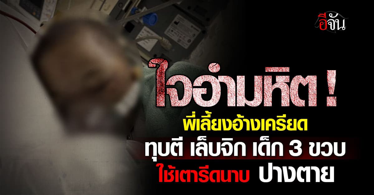 พี่เลี้ยงอำมหิต ! ทำร้ายเด็ก 3 ขวบ สาหัส ยายปวดใจ ร้องปวีณาฯ ช่วยเหลือ