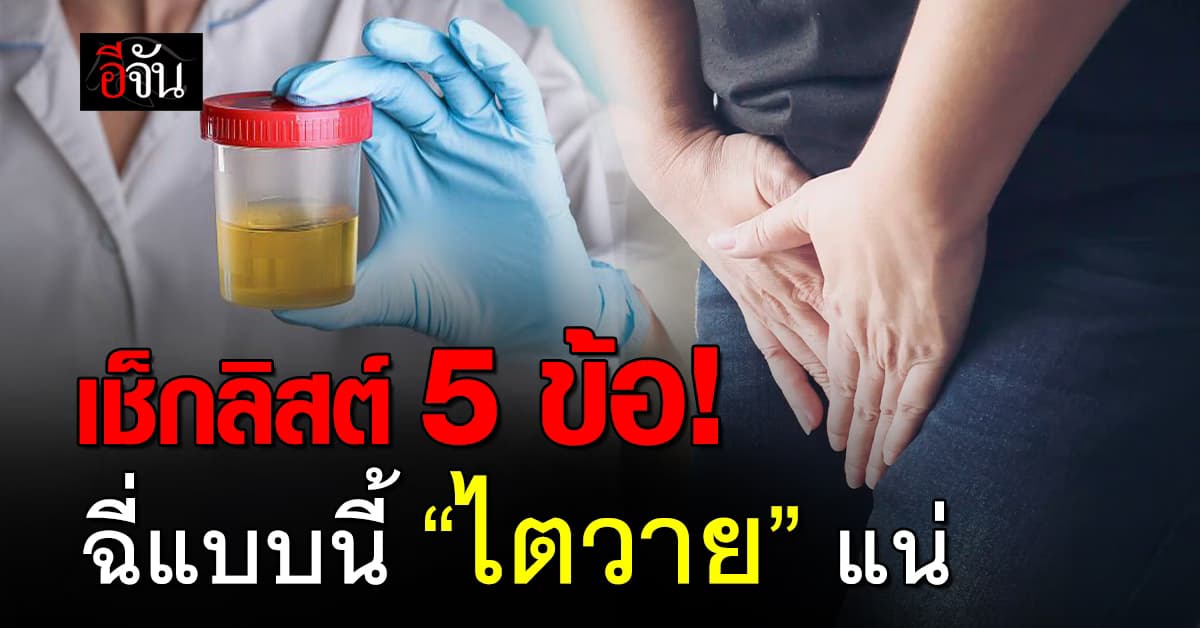 เช็กดู! “ฉี่” ของเราเป็นแบบไหน ถึงเสี่ยงเป็น “ไตวาย” มากสุด 