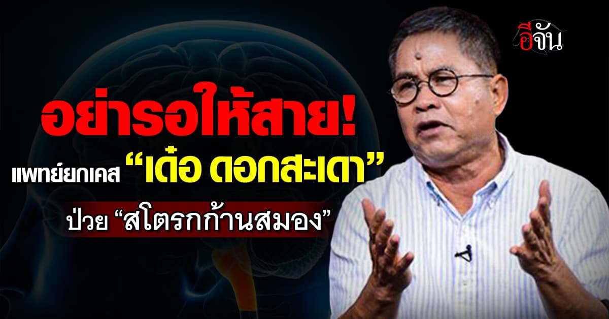อย่ารอให้สาย! แพทย์ยกเคส “เด๋อ ดอกสะเดา” ป่วยสโตรกก้านสมอง