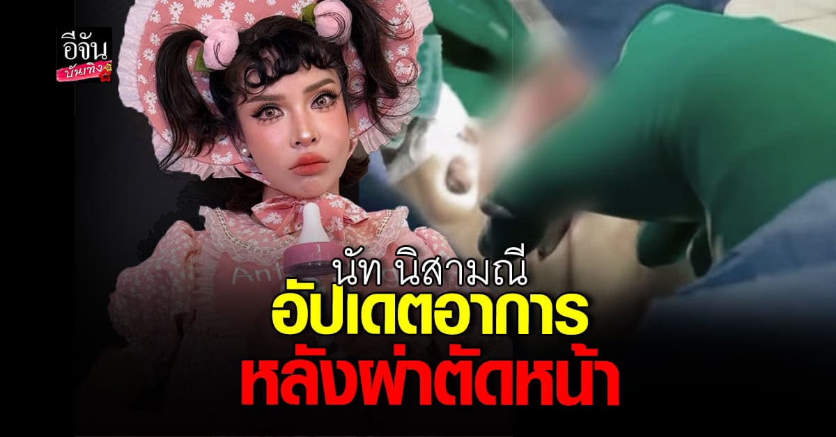 นัท นิสามณี อัปเดตอาการ หลังผ่าหน้าเน่าเพราะหมอกระเป๋า