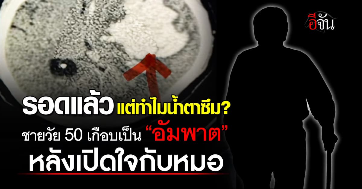 ชายวัย 50 เกือบเป็น “อัมพาต” หลังเปิดใจเรื่องที่ห่วงกับหมอ