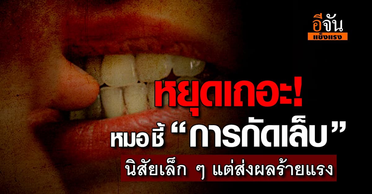 มันมีเชื้อโรค! หมอ ชี้ “การกัดเล็บ” ทำให้เชื้อโรคสามารถเข้าสู่ร่างกายได้ง่าย 
