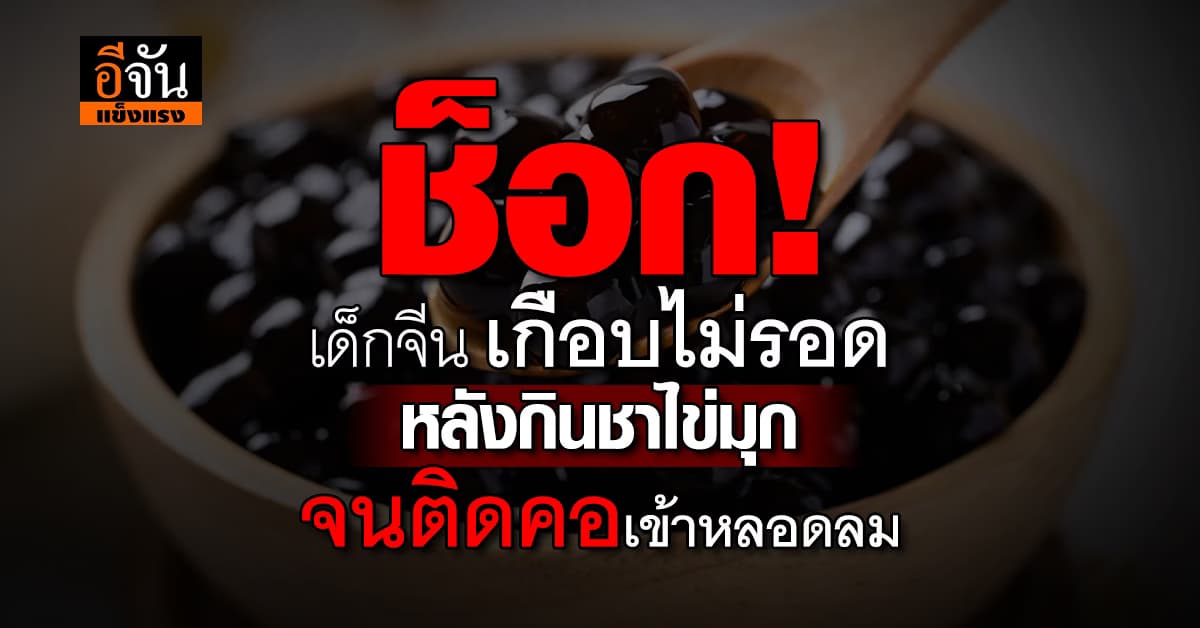 เกือบแล้วหนูเอ้ย! หลังเด็กจีน กินชาไข่มุกจนติดคอเข้าหลอดลม 