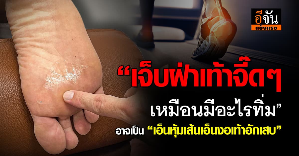 เตือนภัย!  เจ็บฝ่าเท้าจี๊ด ๆ อาจเป็น “เอ็นหุ้มเส้นเอ็นงอเท้าอักเสบ” 