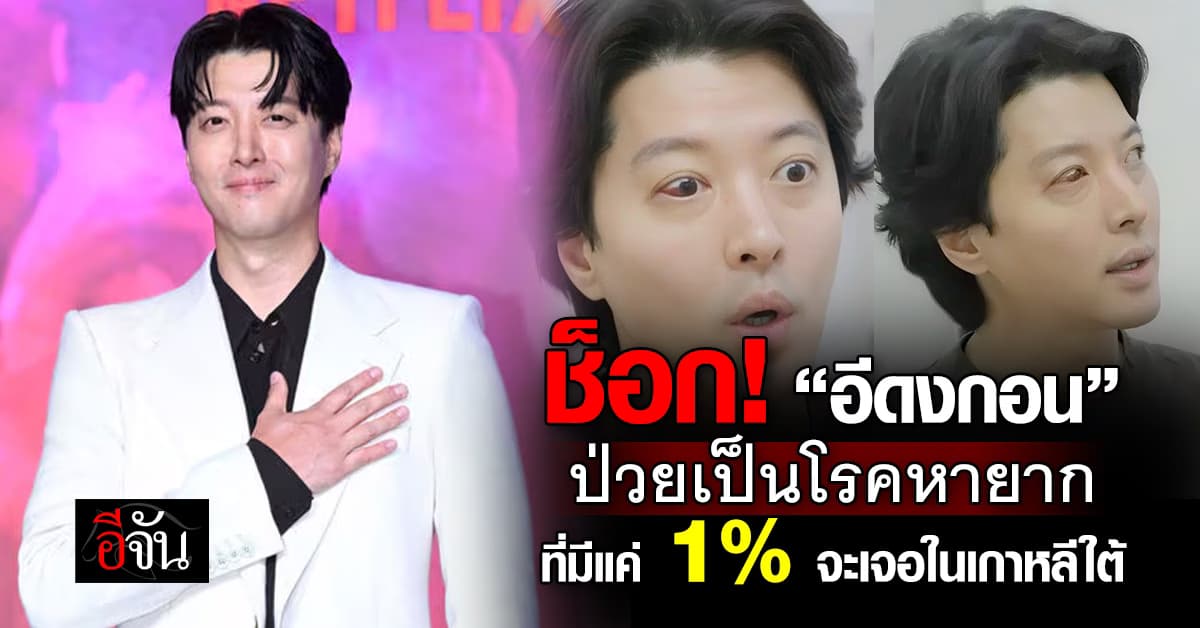 พระเอกดัง “อีดงกอน” ป่วยเป็นโรคหายากที่เป็นทุกเดือน/ครั้ง 