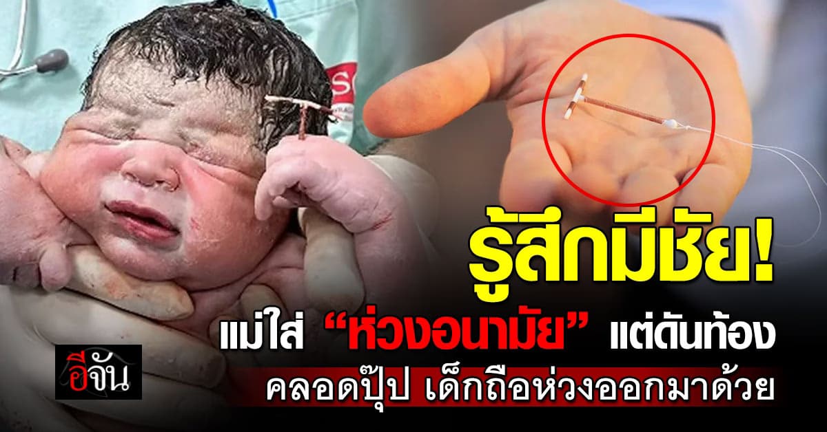 เเม่ใส่ “ห่วงอนามัย” เเต่ดันท้อง หมอบอก คนจะเกิดคุมกำเนิดก็เอาไม่อยู่ 