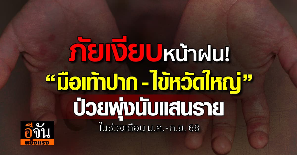 2 โรค มหันตภัย! “มือเท้าปาก-ไข้หวัดใหญ่” ป่วยพุ่งสะสมแล้วนับแสนราย 