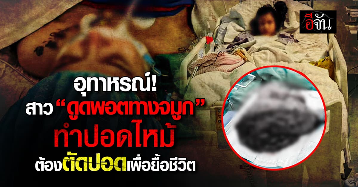 อุทาหรณ์! สาวแอดมิทด่วนเพราะ “ดูดพอตทางจมูก”   