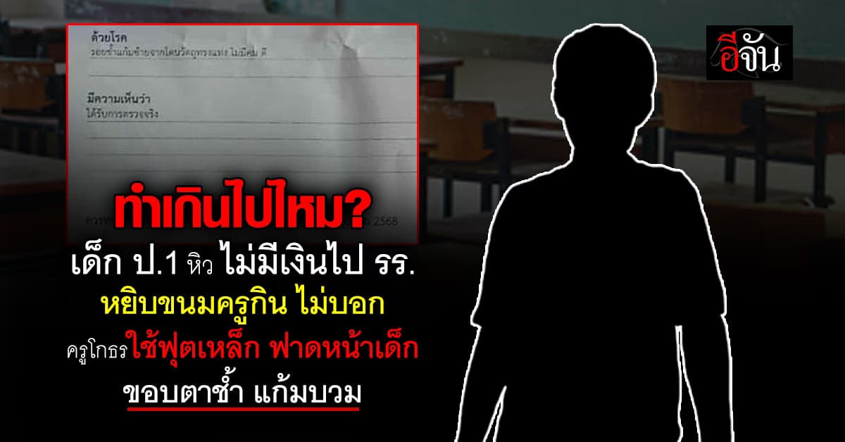 เด็ก ป.1 ไม่มีเงินไป รร. หยิบขนมครูกิน ครูใช้ฟุตเหล็ก ฟาดหน้าเด็ก