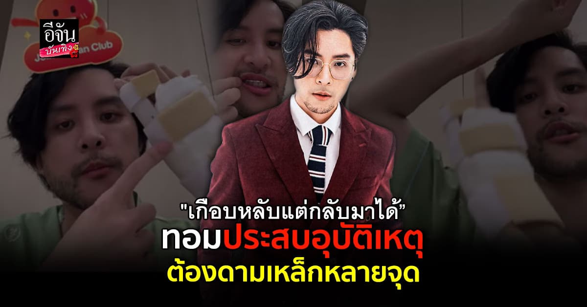 ทอม อิศรา เปิดใจหลังประสบอุบัติเหตุ สกู๊ตเตอร์ล้ม เจ็บหนักไปทั้งตัว