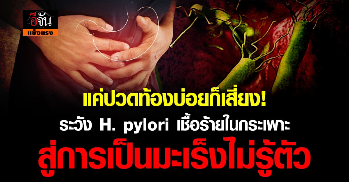 ระวัง! H. pylori เชื้อร้ายในกระเพาะ กลายเป็นมะเร็งไม่รู้ตัว