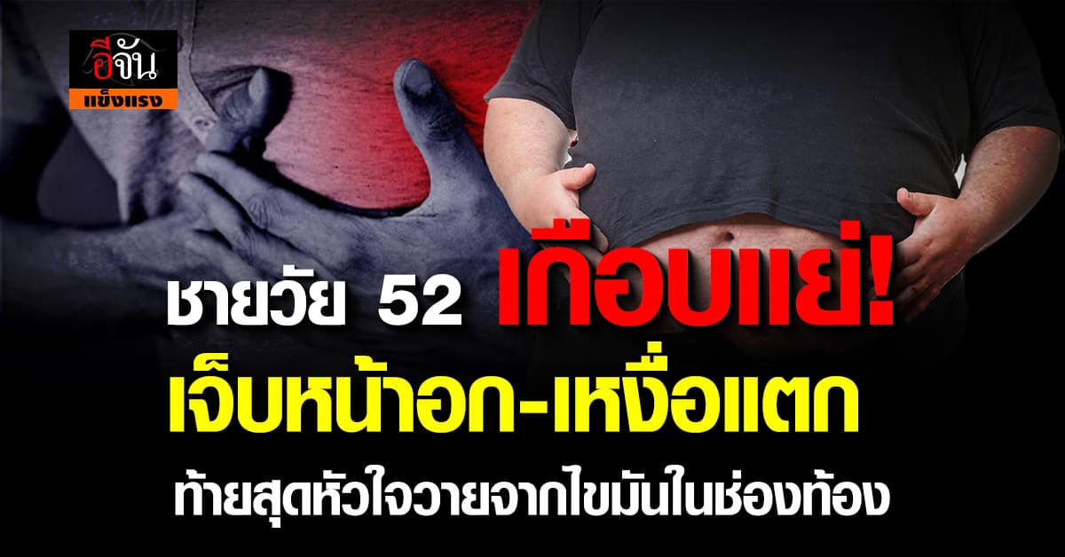 หมอ ยกเคสเตือน! ชายวัย 52 ป่วยไขมันในช่องท้องที่ล้อมรอบหัวใจ 