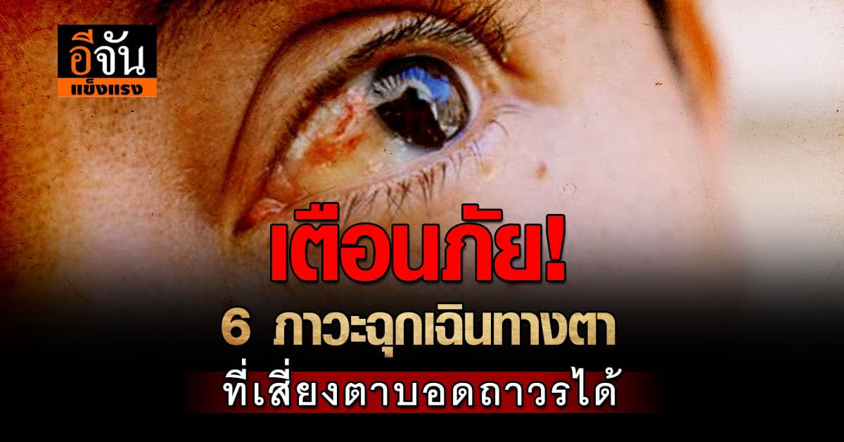 อย่ามองข้าม! เตือน 6 สัญญาณฉุกเฉินทางตาที่เสี่ยงตาบอดถาวรได้  