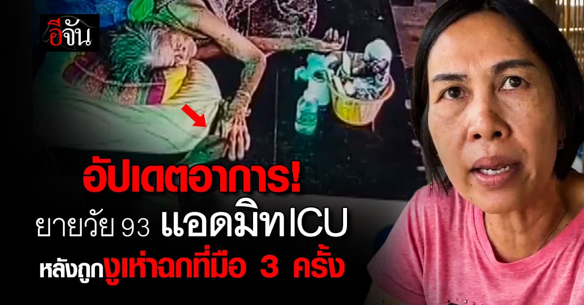 อัปเดตอาการ! ยายวัย 93 ถูกงูเห่าฉกเข้าที่มือ ต้องแอดมิท ICU