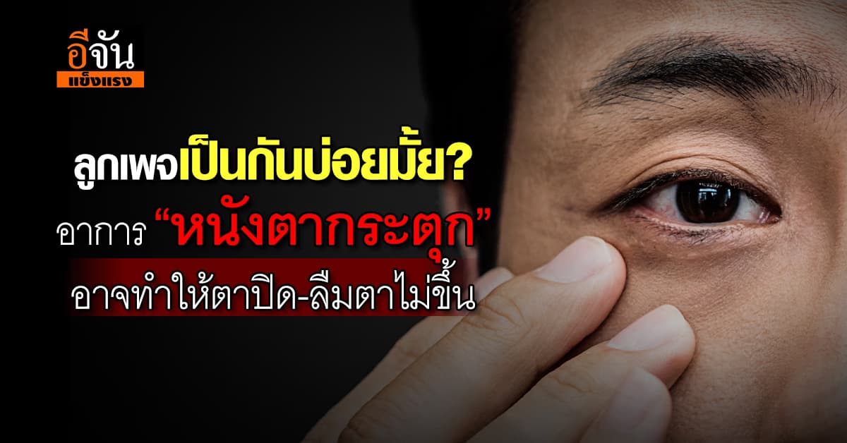 เคยมั้ย? เครียด-นอนน้อย อาจเสี่ยงเป็น “หนังตากระตุก”