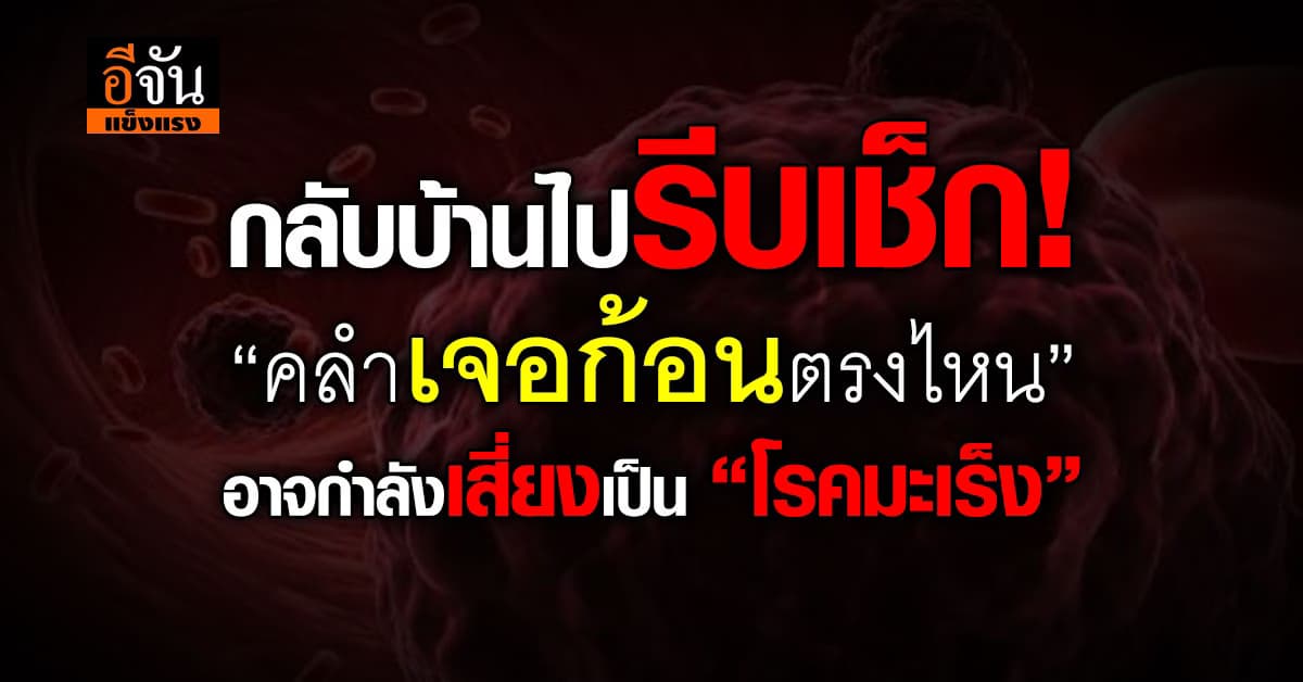 ภัยเงียบ ถ้าไม่ตรวจ = เสี่ยง! “คลำเจอก้อนตรงไหน” ระวังเสี่ยง โรคมะเร็ง  