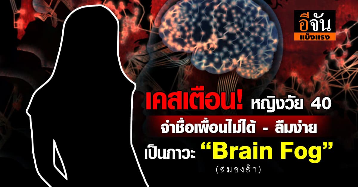 เตือนภัย! เคสอุทาหรณ์หญิงทำงานวัย 40 เป็นภาวะ “Brain Fog”