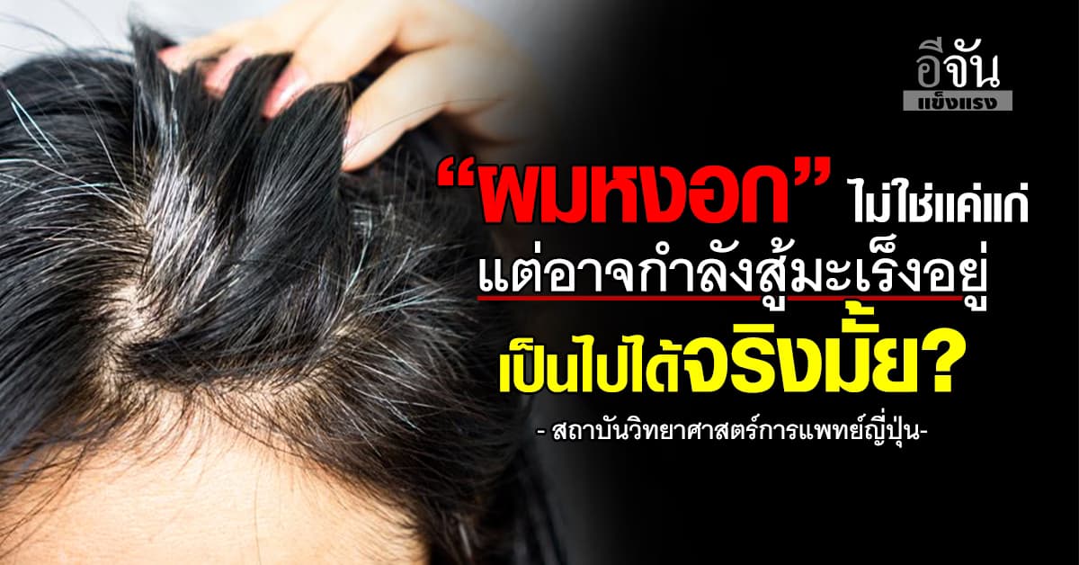 “ผมหงอก” ไม่ได้บ่งบอกเเค่ความแก่แต่อาจกำลังสู้มะเร็งอยู่ จริงมั้ย?  