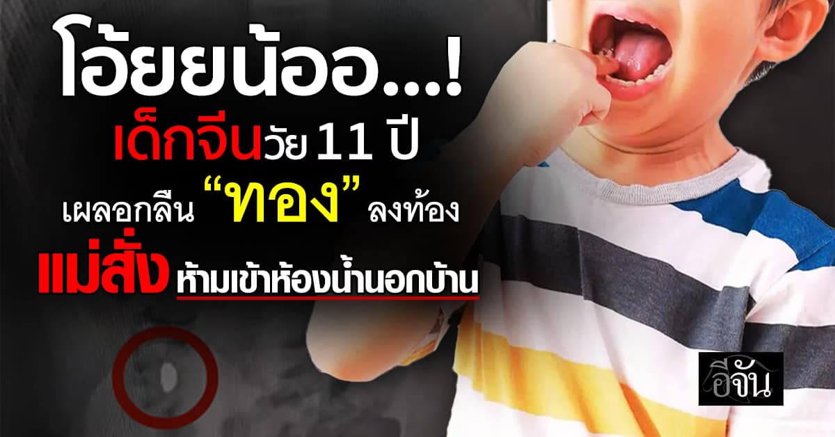 ปวดหัวเลยเด้อ! เมื่อเด็กจีน เผลอกลืนเม็ดทองคำ เข้าไป