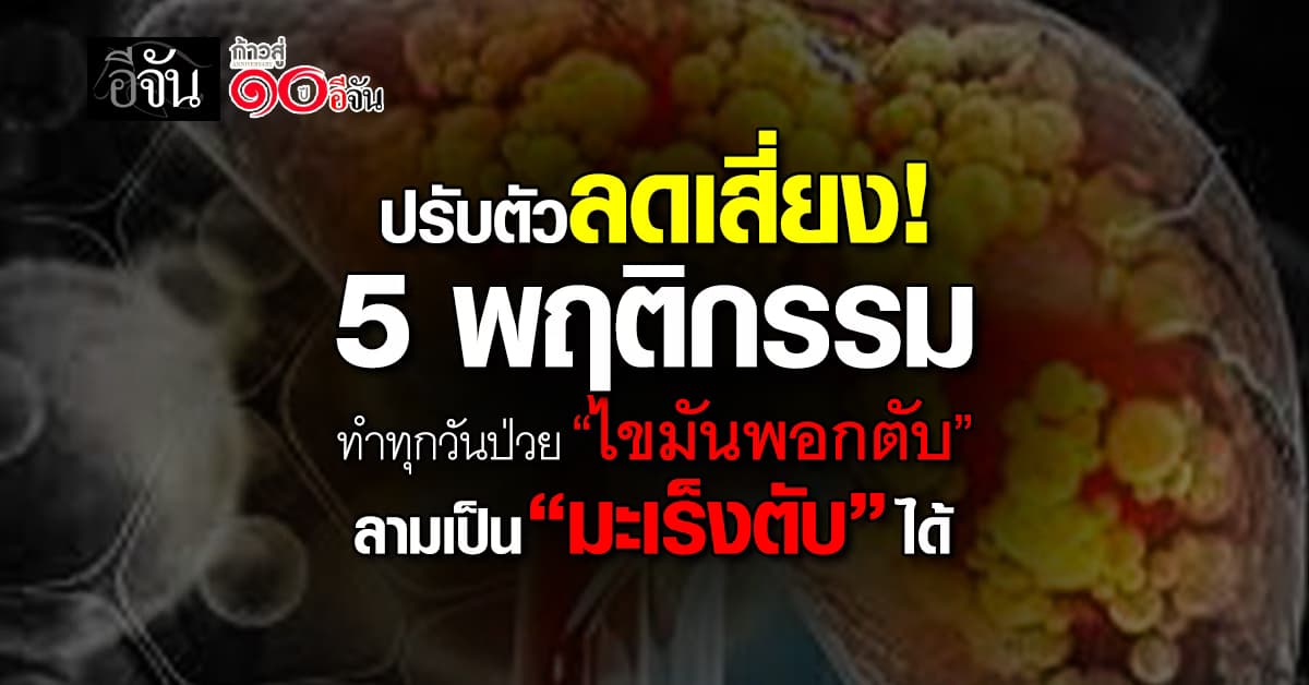 ทำเเบบนี้ไม่ดีหรอก! 5 พฤติกรรม ทำทุกวัน เสี่ยง “ไขมันพอกตับ” 