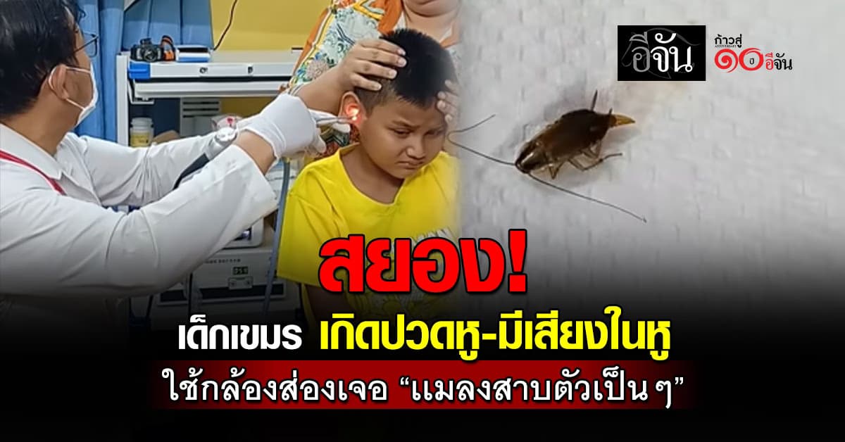 สยองเกินไป!  เด็กเขมร เกิดปวดหู-มีเสียงในหู พบมี “เเมลงสาบตัวเป็นๆ”  