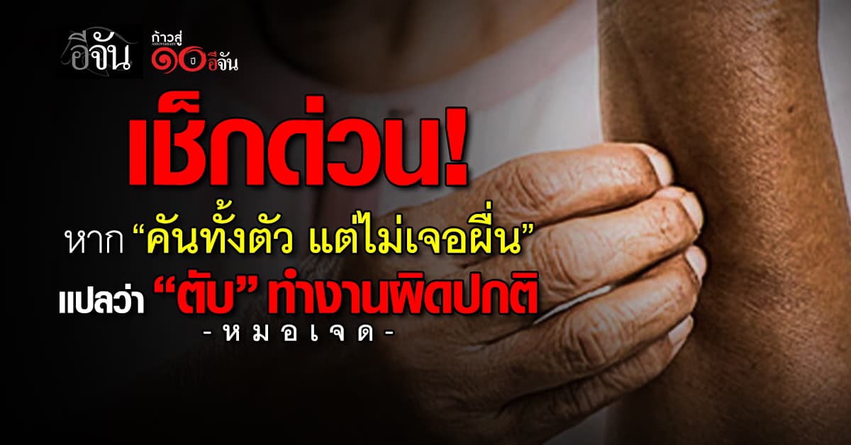 น่ากลัวมาก! ถ้ามีอาการ “คันทั้งตัว แต่ไม่เจอผื่น” เสี่ยง “ตับ” มีปัญหา