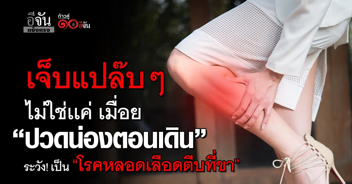 ใครเคยเป็น? เดินแป๊บๆแล้วน่องตึง ปวดจี๊ด ระวังเป็น “โรคหลอดเลือดตีบที่ขา”  