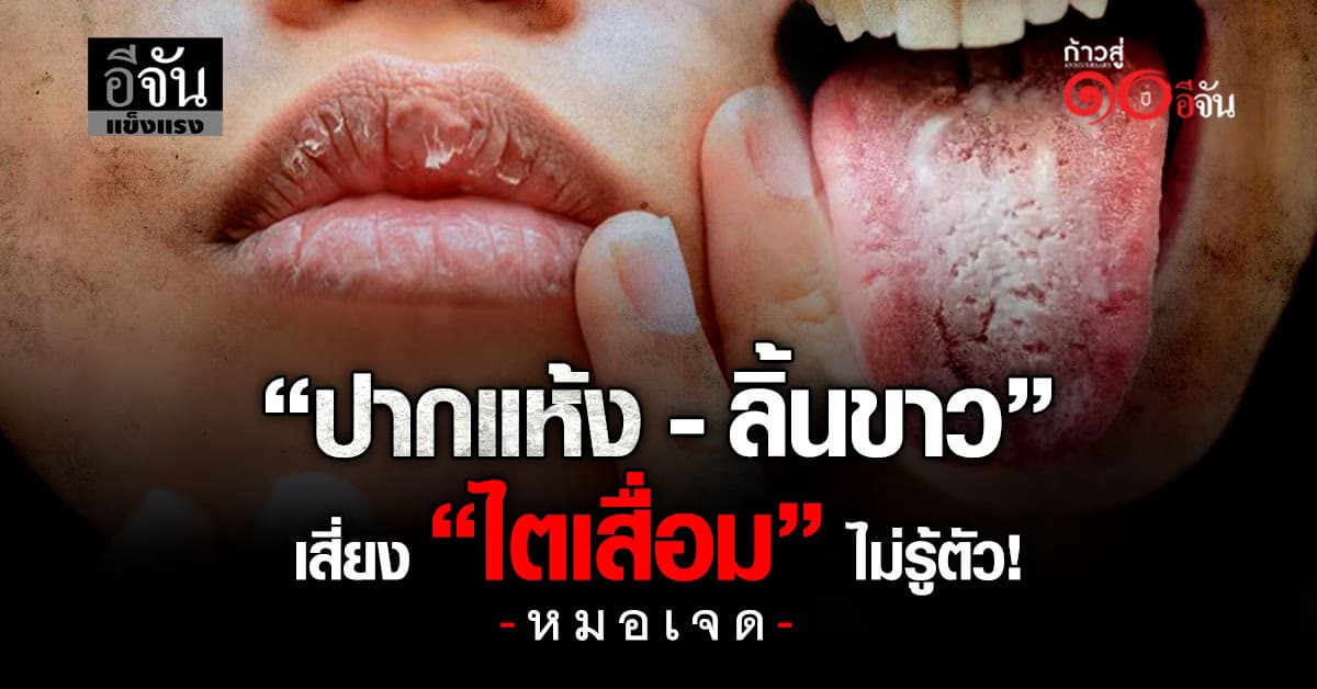 อาการง่ายๆที่ป่วยหนักได้! ใครที่มีอาการปากเเห้ง-ลิ้นขาว-ฉี่น้อยลง เสี่ยง ไตพัง  