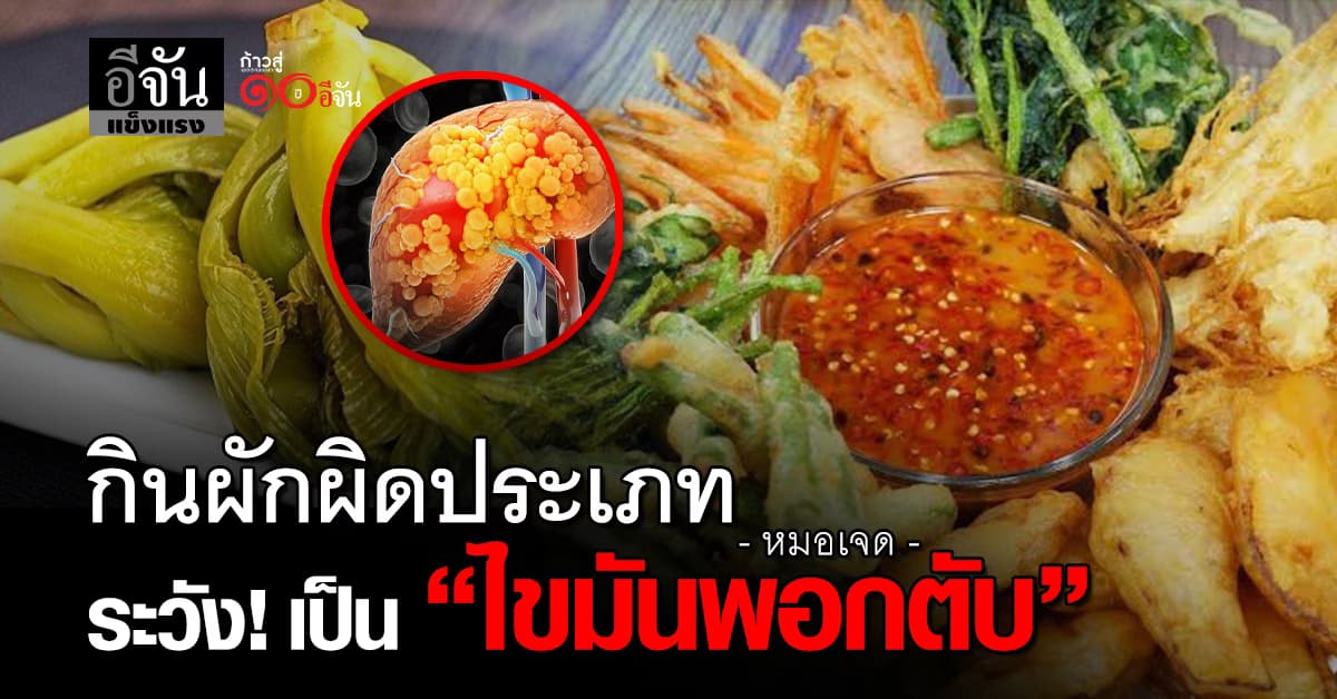 5 ประเภทผัก กินแล้วอาจเสี่ยงเป็น ไขมันพอกตับ 