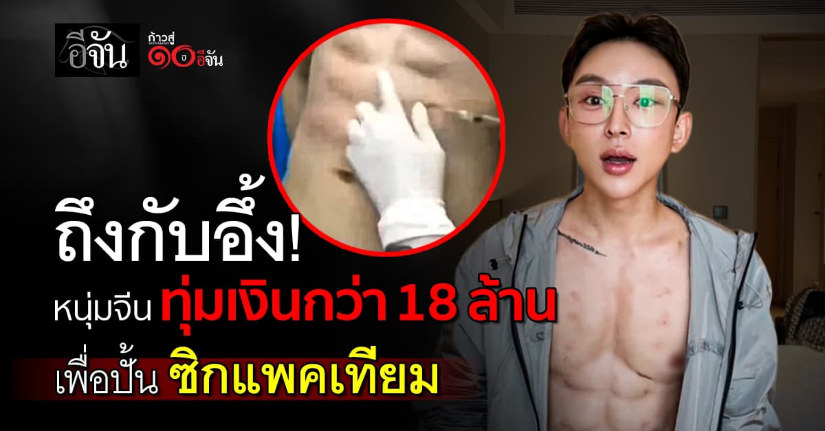 สุดเกิน! หนุ่มจีน ทุ่มเงินกว่า 18 ล้าน ทำซิกแพคเทียม