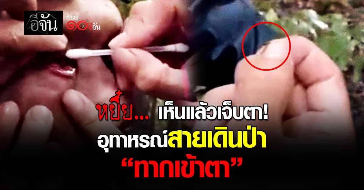 หยึ๋ย… แค่คิดก็ตาเขม่นแล้ว! อุทาหรณ์สายเดินป่า “ทากเข้าตา!”