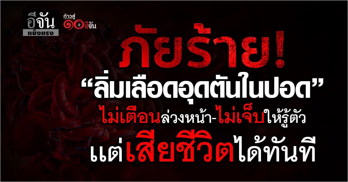 อย่าปล่อยไว้! อาการ “ลิ่มเลือดอุดตันในปอด” อันตรายถึงตายได้  