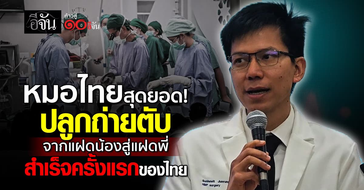 แพทย์ มช. ทำได้! ปลูกถ่ายตับ แฝดสู่แฝด คู่แรกของประเทศไทย