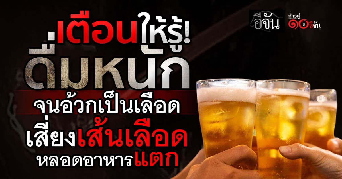 ยกเคสเตือน ชายวัย 50 ดื่มหนักจนอ้วกเป็นเลือด สุดท้าย เส้นเลือดหลอดอาหารแตก