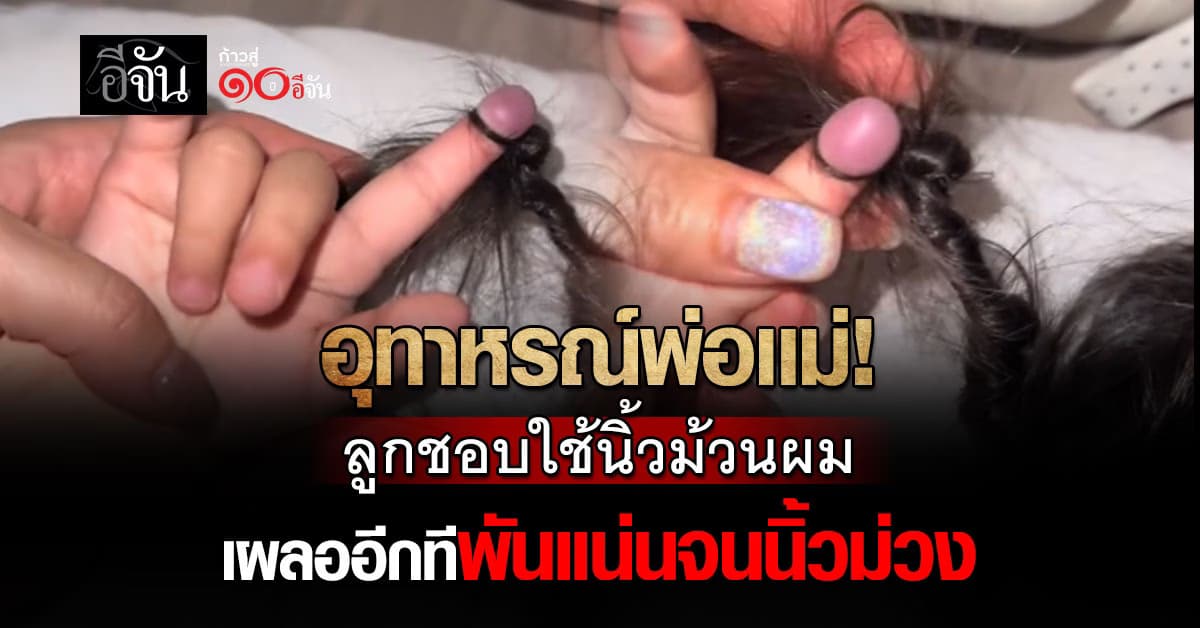 เลือดเเทบไม่เดิน! เเม่เเชร์อุทาหรณ์ ลูกชอบใช้นิ้วม้วนผมจนพันกันเเน่น จนนิ้วม่วงก่ำ  
