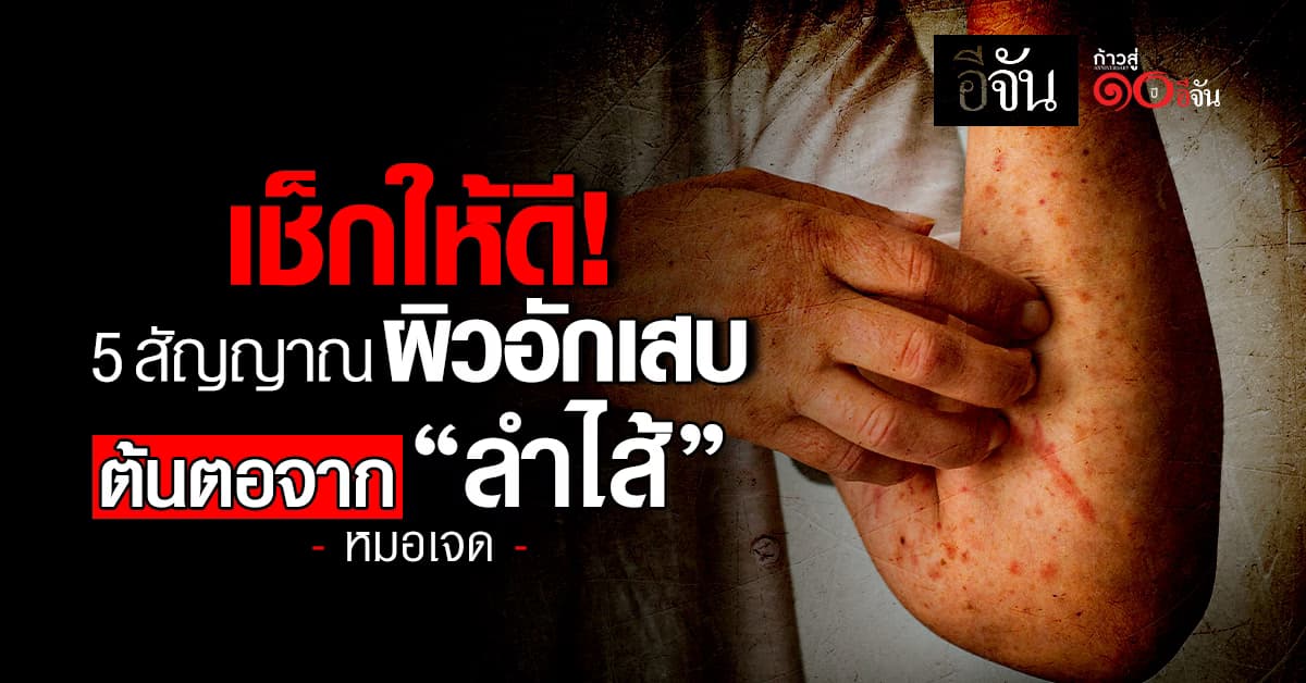 หมอเจดเตือน 5 สัญญาณ “ผิวอักเสบ” ที่มีต้นตอจาก “ลำไส้”