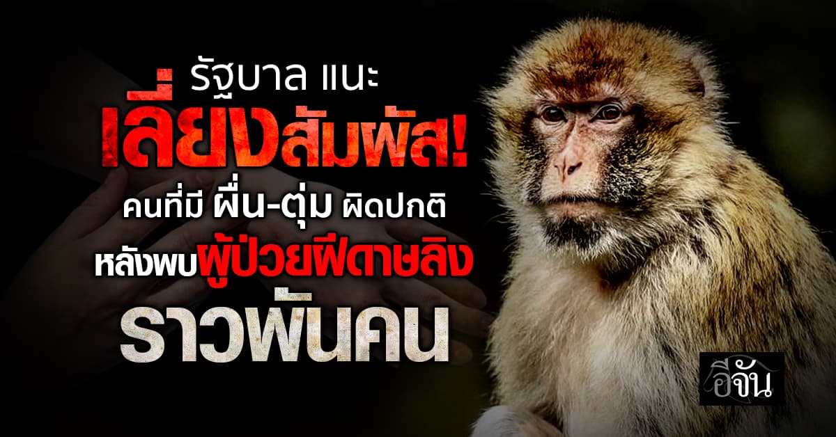 รัฐบาล แนะเลี่ยงสัมผัส! คนที่มี ผื่น-ตุ่ม ผิดปกติ หลังพบ “ผู้ป่วยฝีดาษลิง” ราวพันคน