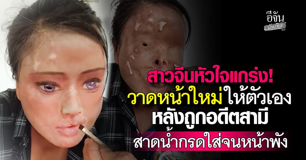 สาวจีนหัวใจแกร่ง! ถูกอดีตสามีสาดน้ำกรดใส่ ใบหน้าเสียโฉม ขอวาดใบหน้าใหม่ให้ตัวเอง
