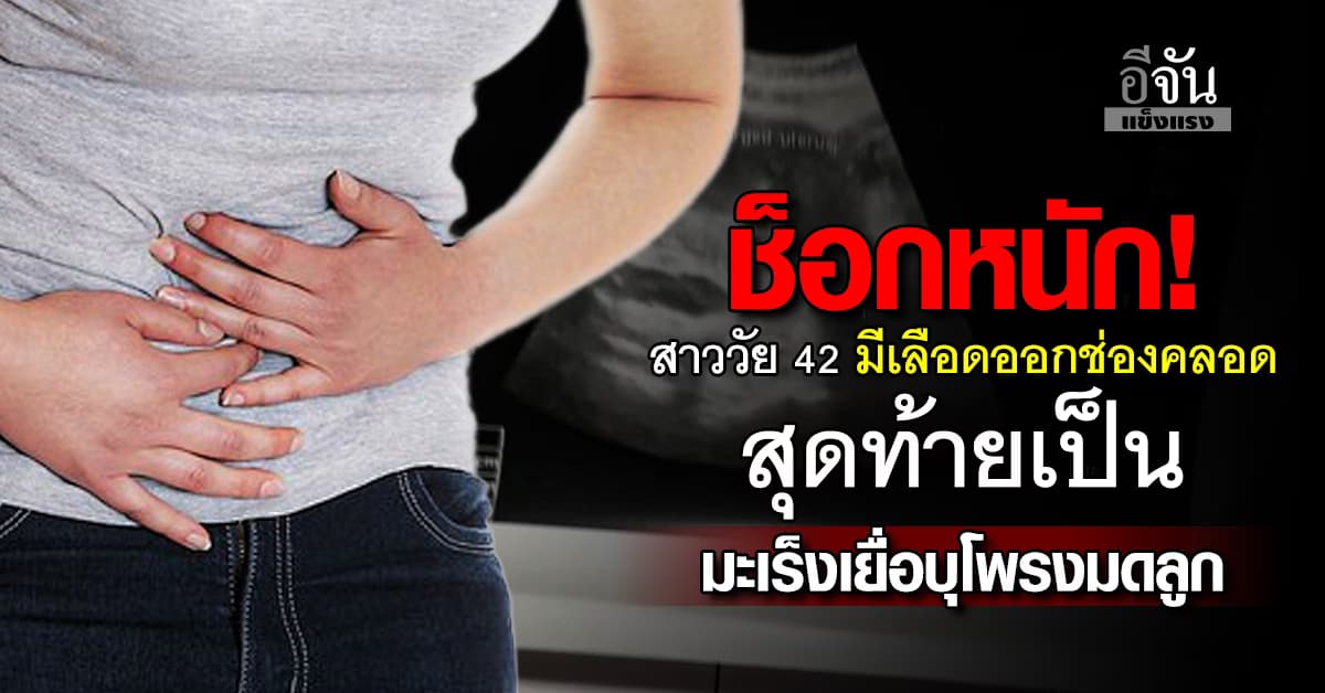 ช็อก! สาว 42 มีเลือดออกกะปริบกะปรอย นอกช่วงประจำเดือน สุดท้ายเป็นโรคร้าย  