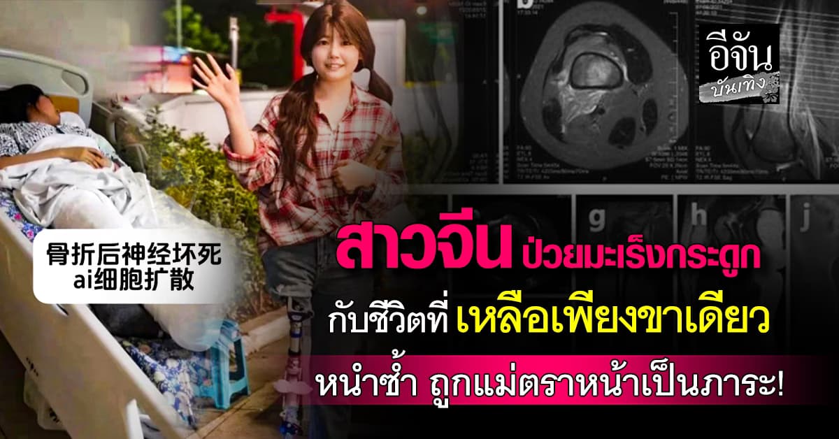 เรื่องสุดสะเทือนใจของสาวจีน! เสียขา เสียครอบครัว แต่ไม่เคยเสียความหวัง